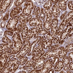 HSDL2 Antibody, Novus Biologicals:Antibodies:Primary Antibodies