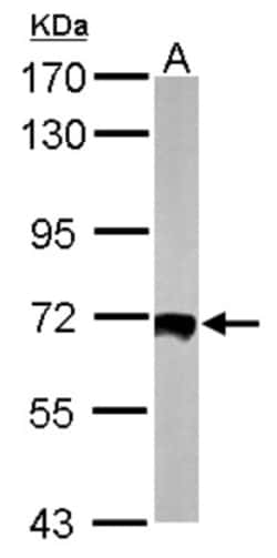 HSF2 Antibody, Novus Biologicals 0.1mL; Unlabeled:Antibodies, Polyclonal
