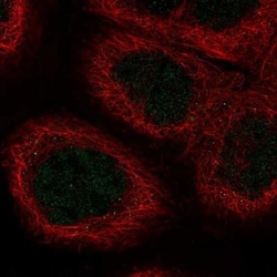 Versican Antibody, Novus Biologicals:Antibodies:Primary Antibodies