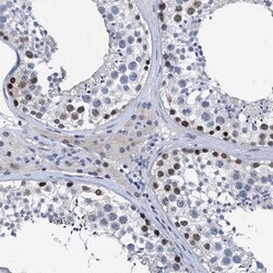 Versican Antibody, Novus Biologicals:Antibodies:Primary Antibodies