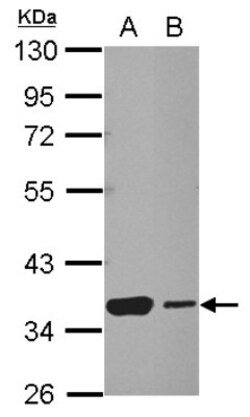 HSF2BP Antibody, Novus Biologicals 0.1mL; Unlabeled:Antibodies, Polyclonal