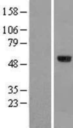 Novus Biologicals&trade;&nbsp;HSFX1/2 Overexpression Lysate