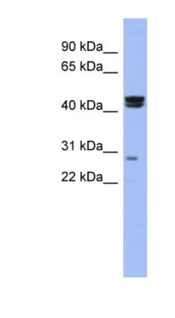 HSFY1 Antibody, Novus Biologicals 100&mu;L; Unlabeled:Antibodies, Polyclonal