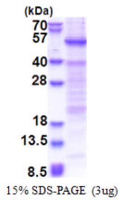 Novus Biologicals&trade;&nbsp;Recombinant Human HSFY1 His Protein