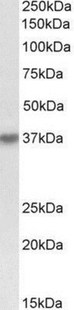 HSH2D Antibody, Novus Biologicals 0.1mg; Unlabeled:Antibodies, Polyclonal