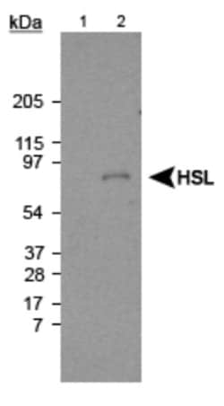 Hormone-sensitive Lipase/HSL Antibody, Novus Biologicals:Antibodies:Primary