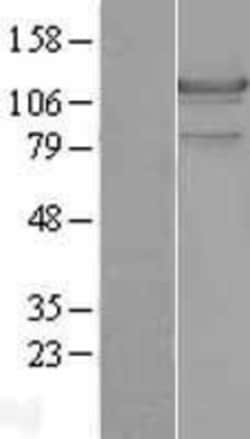Novus Biologicals&trade;&nbsp;Hormone-sensitive Lipase/HSL Overexpression Lysate