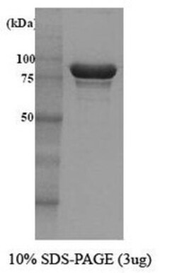 Novus Biologicals&trade;&nbsp;Recombinant Yeast Hsp104 Protein