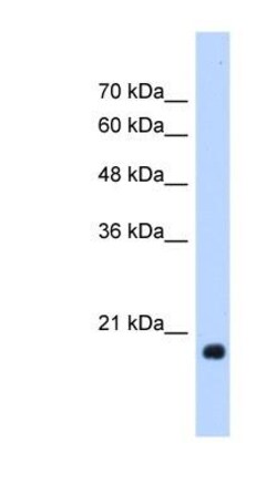 HSP20/HSPB6 Antibody, Novus Biologicals 0.1mg; Unlabeled:Antibodies, Polyclonal