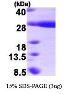 Novus Biologicals&trade;&nbsp;Recombinant Human HSPB8/HSP22 His Protein