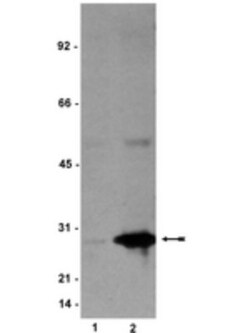 HSP27, p Ser78 Antibody (JBW502), Novus Biologicals 0.025 mg; Unconjugated:Antibodies,