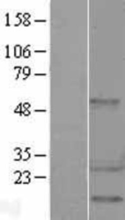 Novus Biologicals&trade;&nbsp;HSP27 Overexpression Lysate
