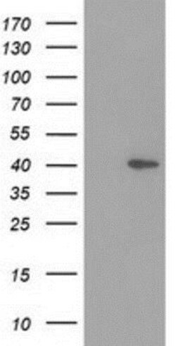 HSP40/DNAJB1 Antibody (OTI1F9), Novus Biologicals 0.1mL; Unlabeled:Antibodies,