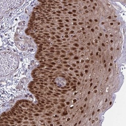 HSP40/DNAJB1 Antibody, Novus Biologicals 0.1mL; Unlabeled:Antibodies, Polyclonal