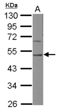 Hsp47 Antibody, Novus Biologicals 0.1mL; Unlabeled:Antibodies, Polyclonal