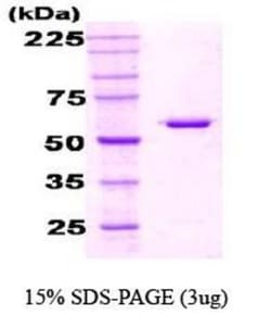 Novus Biologicals&trade;&nbsp;Recombinant E. coli HSP60 Protein