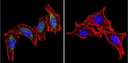 HSP60 Antibody (4B9/89) - Azide and BSA Free, Novus Biologicals 0.025 mg,
