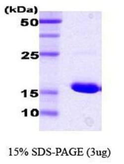 Novus Biologicals&trade;&nbsp;Recombinant E. coli HSP70/HSPA1A Protein