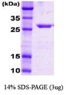 Novus Biologicals&trade;&nbsp;Recombinant E. coli HSP70/HSPA1A Protein