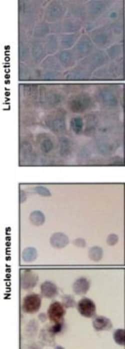 HSP70/HSPA1A Antibody (BB70), Novus Biologicals 0.2mg; Unlabeled:Antibodies,