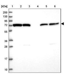 HspA1L Antibody, Novus Biologicals 0.1mL; Unlabeled:Antibodies, Polyclonal