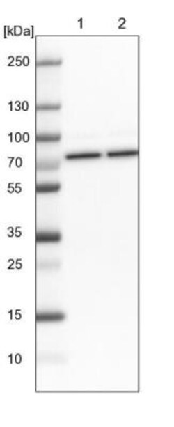 HspA1L Antibody, Novus Biologicals 0.1mL; Unlabeled:Antibodies, Polyclonal