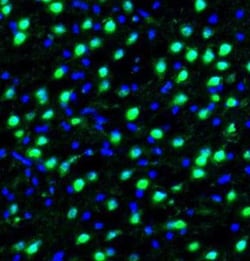 DDX1 Antibody, Novus Biologicals:Antibodies:Primary Antibodies