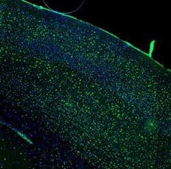 DDX1 Antibody, Novus Biologicals:Antibodies:Primary Antibodies