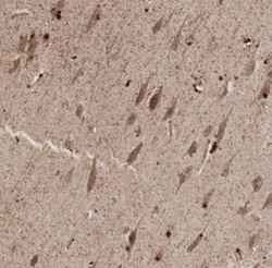 DDX1 Antibody, Novus Biologicals:Antibodies:Primary Antibodies