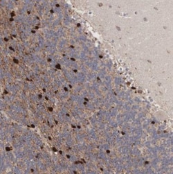 DDX1 Antibody, Novus Biologicals:Antibodies:Primary Antibodies