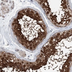 HspA6 Antibody, Novus Biologicals:Antibodies:Primary Antibodies
