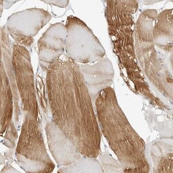 HspB7 Antibody, Novus Biologicals 0.1mL; Unlabeled:Antibodies, Polyclonal