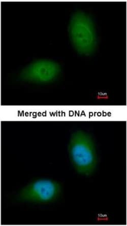 HSPB8/HSP22 Antibody, Novus Biologicals 100 &mu;L | Buy Online | Novus Biologicals | Fisher Scientific