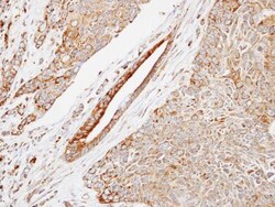 HSPB8/HSP22 Antibody, Novus Biologicals 100 &mu;L | Buy Online | Novus Biologicals | Fisher Scientific