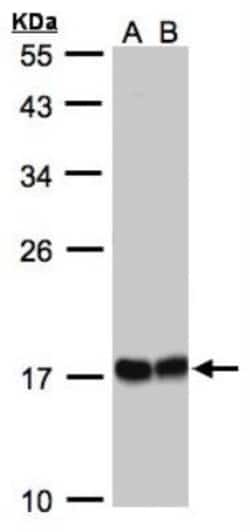 HSPB8/HSP22 Antibody, Novus Biologicals 100 &mu;L | Buy Online | Novus Biologicals | Fisher Scientific