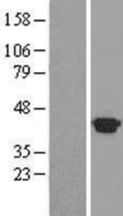 Novus Biologicals&trade;&nbsp;HspBP1 Overexpression Lysate