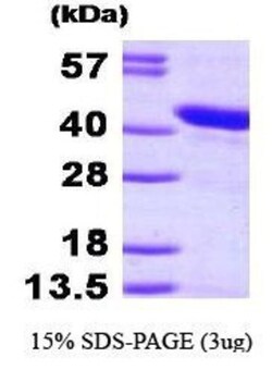 Novus Biologicals&trade;&nbsp;Recombinant Human HspBP1 His Protein