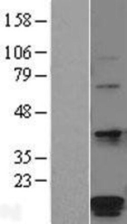 Novus Biologicals&trade;&nbsp;HSPC014 Overexpression Lysate
