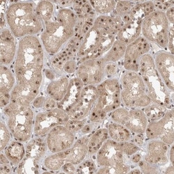 HSPC014 Antibody, Novus Biologicals 25 &mu;L, Unconjugated:Antibodies,