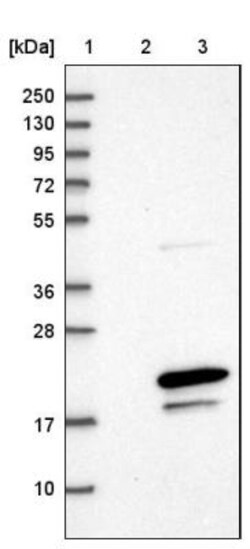 HSPC014 Antibody, Novus Biologicals 25 &mu;L, Unconjugated:Antibodies,