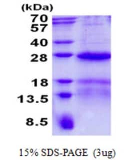 Novus Biologicals&trade;&nbsp;Recombinant Human HSPC111 His Protein