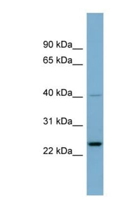 HSPC111 Antibody, Novus Biologicals:Antibodies:Primary Antibodies