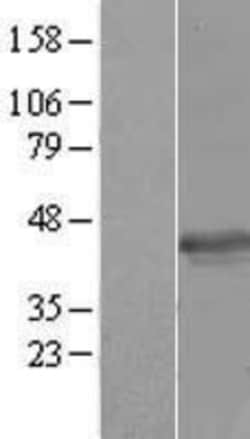 Novus Biologicals&trade;&nbsp;MERIT40/HSPC142 Overexpression Lysate
