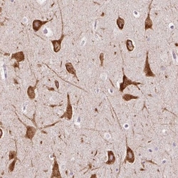 HSPC268 Antibody, Novus Biologicals:Antibodies:Primary Antibodies