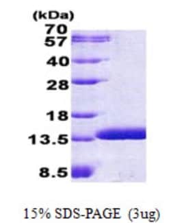 Novus Biologicals&trade;&nbsp;Recombinant Human HSPC280 His Protein