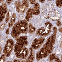 HSPC323 Antibody, Novus Biologicals 0.1mL; Unlabeled:Antibodies, Polyclonal
