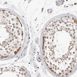 HSPH1/HSP105 Antibody, Novus Biologicals:Antibodies:Primary Antibodies