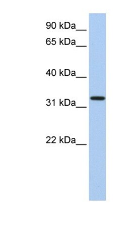 HSU79274 Antibody, Novus Biologicals:Antibodies:Primary Antibodies