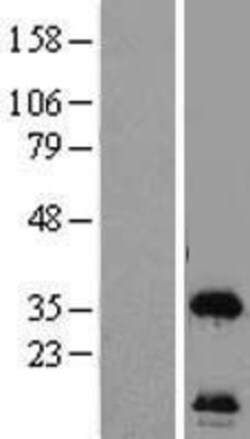 Novus Biologicals&trade;&nbsp;HSU79274 Overexpression Lysate