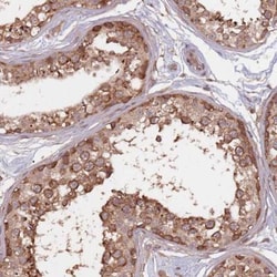 HT021 Antibody, Novus Biologicals:Antibodies:Primary Antibodies